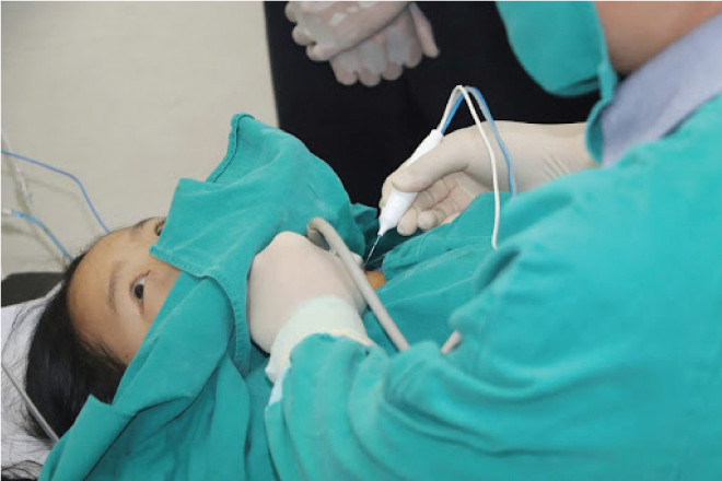 Hình ảnh minh họa phương pháp RFA