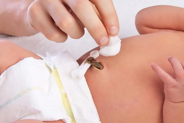 Cách vệ sinh rốn cho trẻ sơ sinh từ A – Z