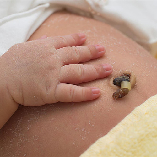 Cách chăm sóc rốn cho trẻ sơ sinh