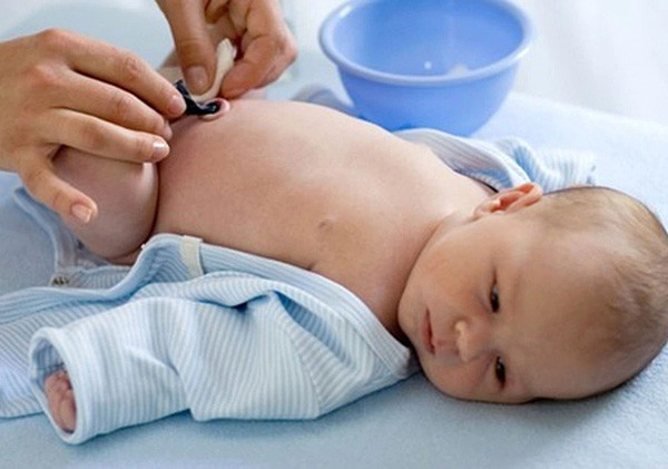 Cách vệ sinh rốn cho trẻ sơ sinh từ A – Z