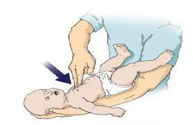 Mách mẹ cách nhận biết và xử trí sặc sữa ở trẻ
