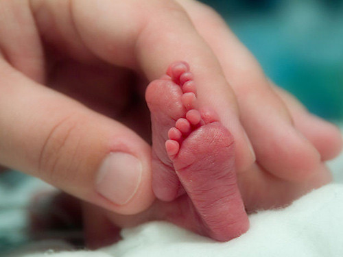 Sinh non: Nguyên nhân, triệu chứng và các xử lý