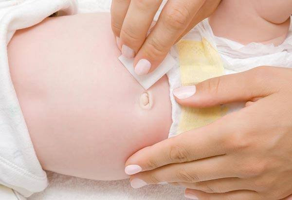 Phòng ngừa nhiễm khuẩn rốn trẻ sơ sinh (Phần 2)