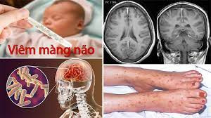 Các bệnh thường gặp của bé yêu vào mùa hè (phần 1)