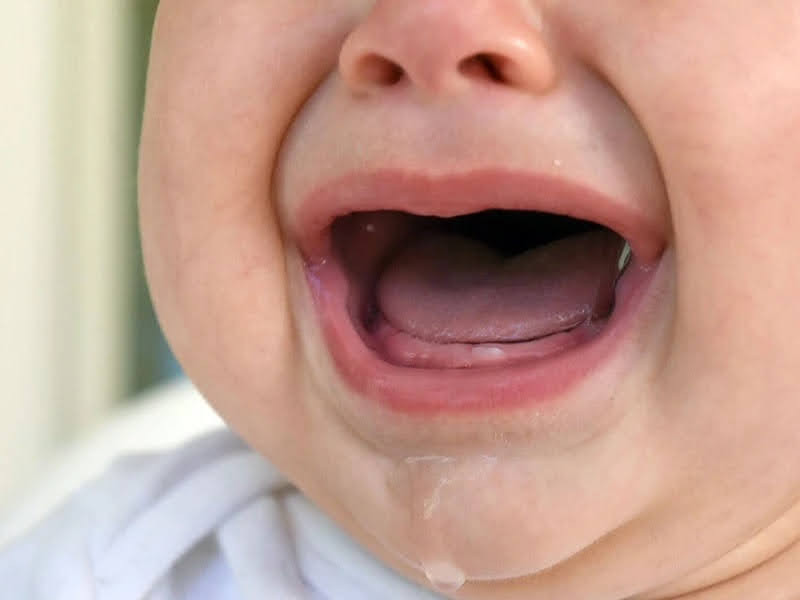 Tại sao bé chậm mọc răng